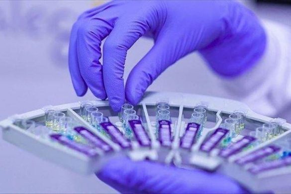 pcr testiranje u srpskoj
