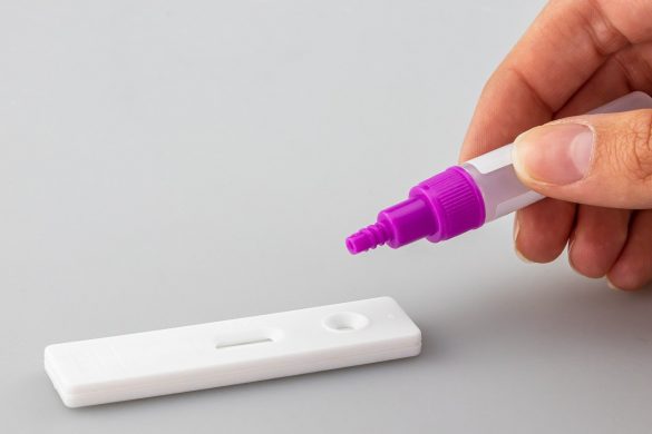 koronavirus doboj