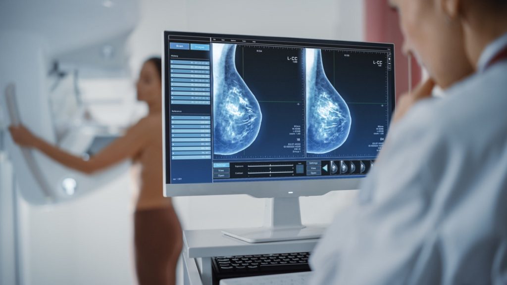 mamografski pregledi doboj